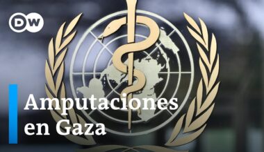 Las amputaciones se han convertido en algo habitual en Gaza, según la OMS