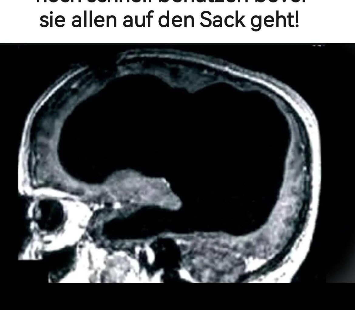 ich🧠iel