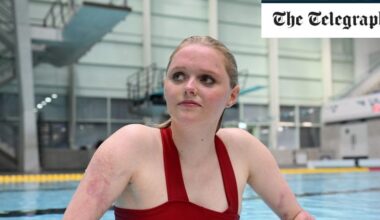 Hollywood dolphin inspired amputee to become Paralympian swimmer