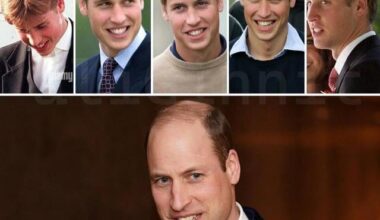 The royal family's hair loss saga: a cautionary tale for all.