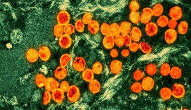 Pakistan reports first case of deadly mpox virus