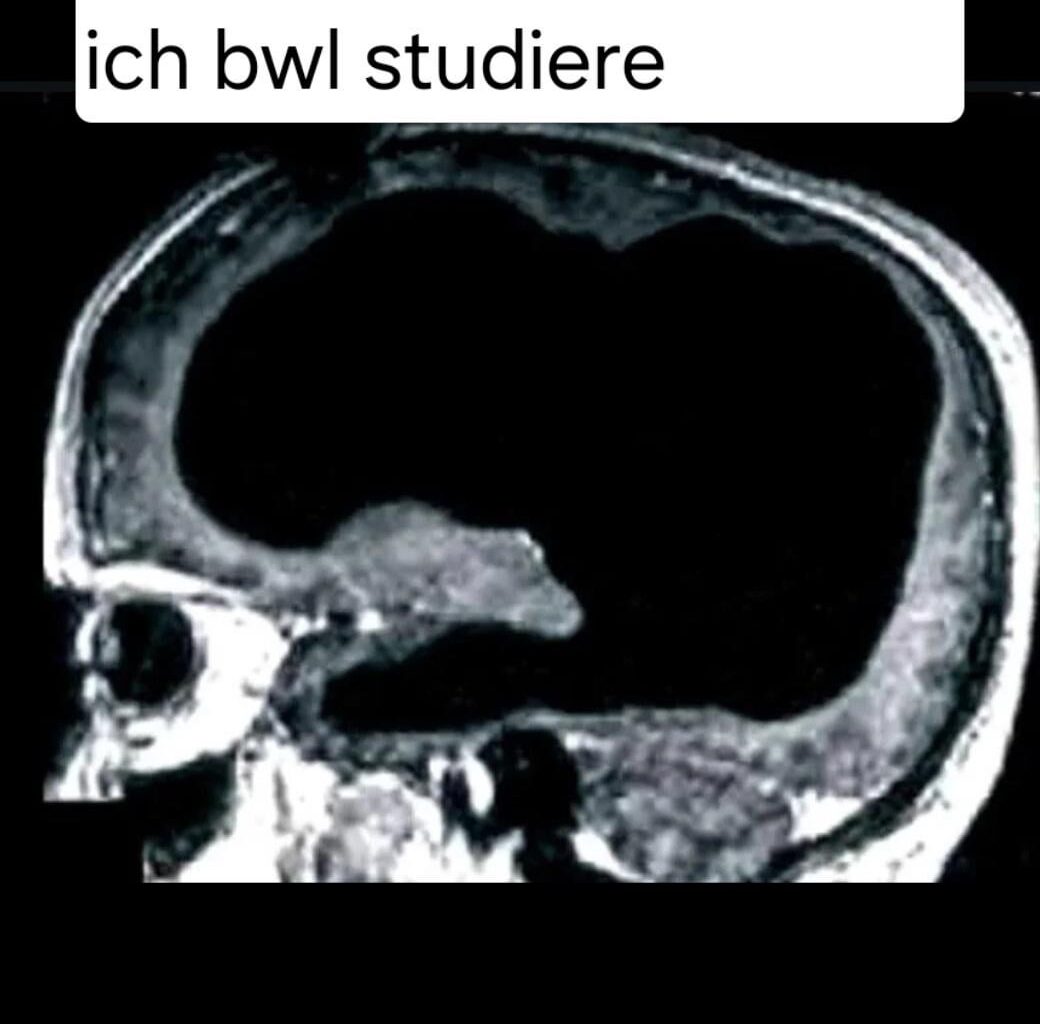 ich🧠iel