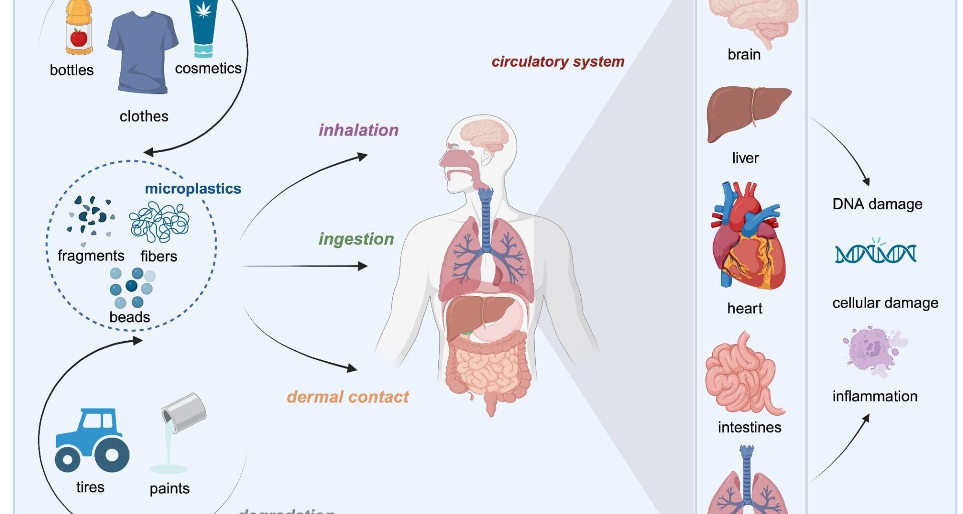 Microplastics: an often-overlooked issue in the transition from chronic inflammation to cancer (2024)