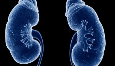 UK-DTOP tool promises improved outcomes for kidney transplant recipients