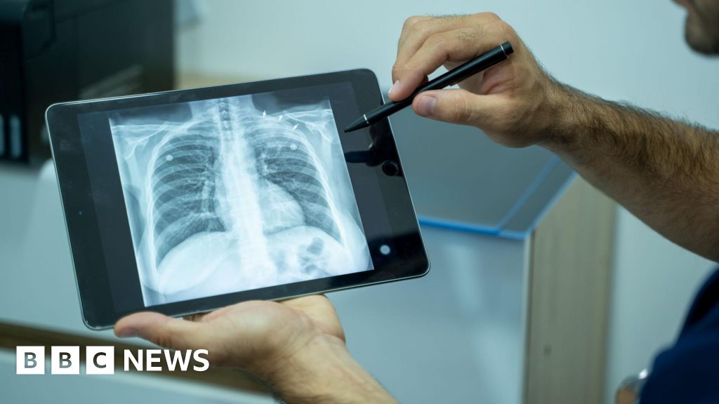 Medical professional holds a tablet showing an X-ray of a pair of lungs