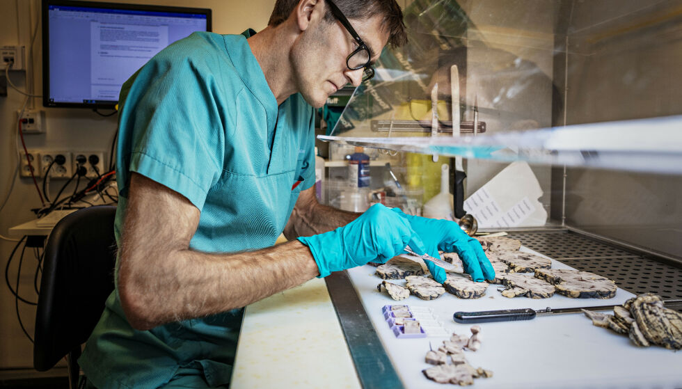 LETER ETTER SVAR: Rettsmedisiner Arne Stray-Pedersen analyserer en menneskehjerne, på jakt etter funn. Foto: Jørn H. Moen