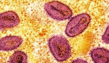 Mpox: Erster Nachweis von neuer Variante Ib in Deutschland