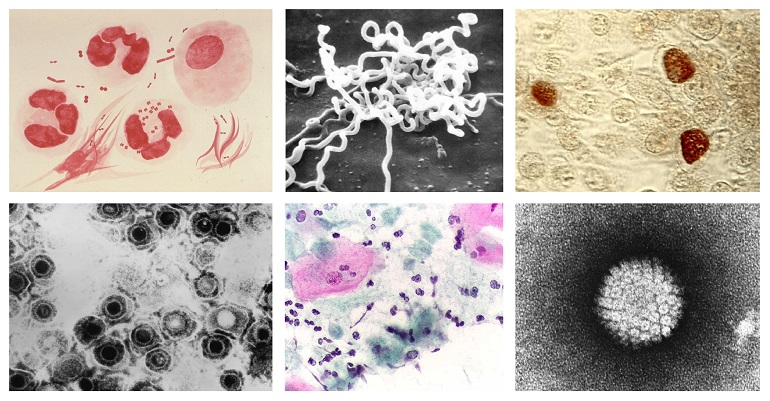 Se mantiene la tendencia creciente de las infecciones de transmisión sexual en España