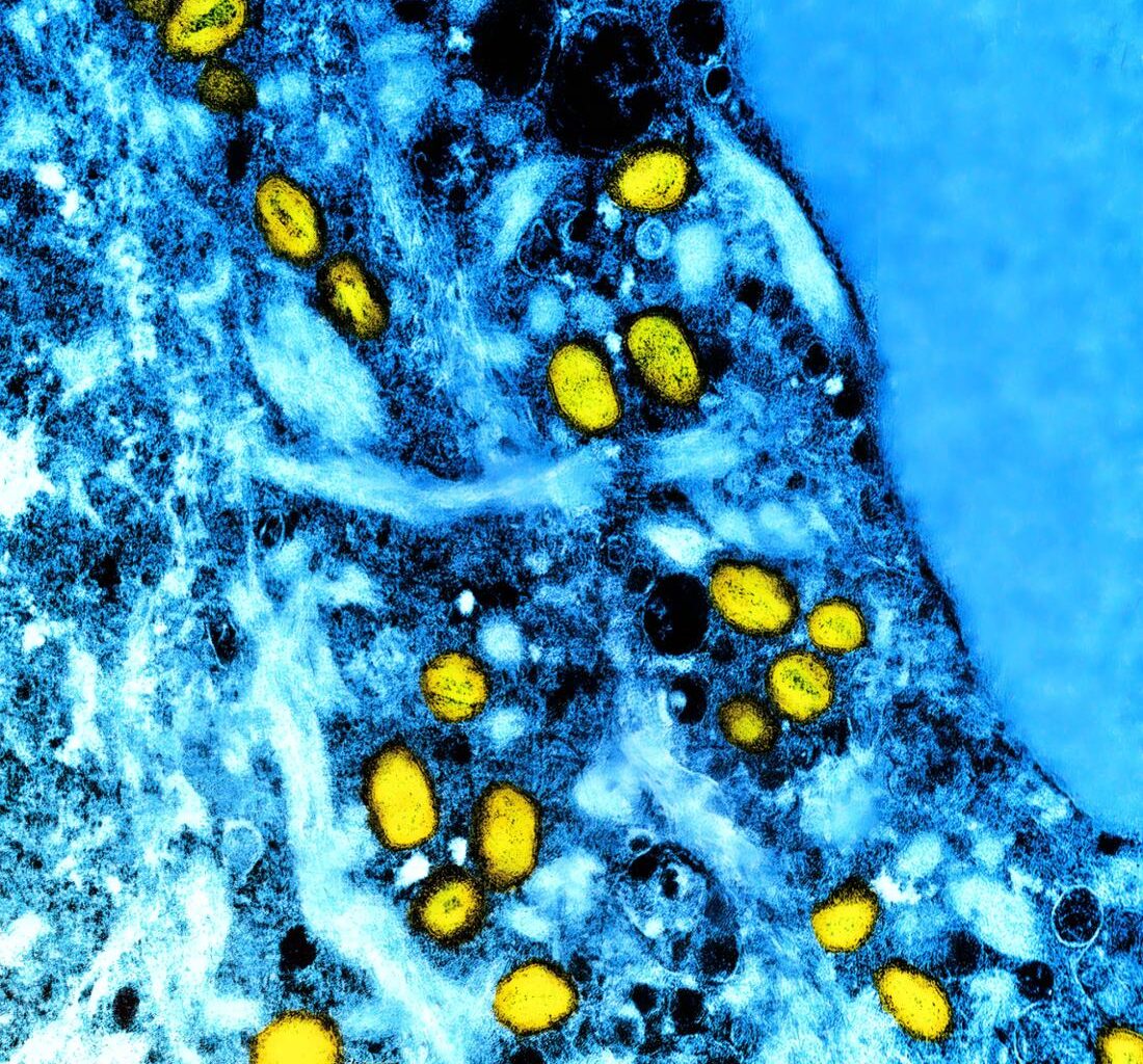 Mpox-Viruspartikel (gelb) unter dem Transmissionenelektronenmikroskop