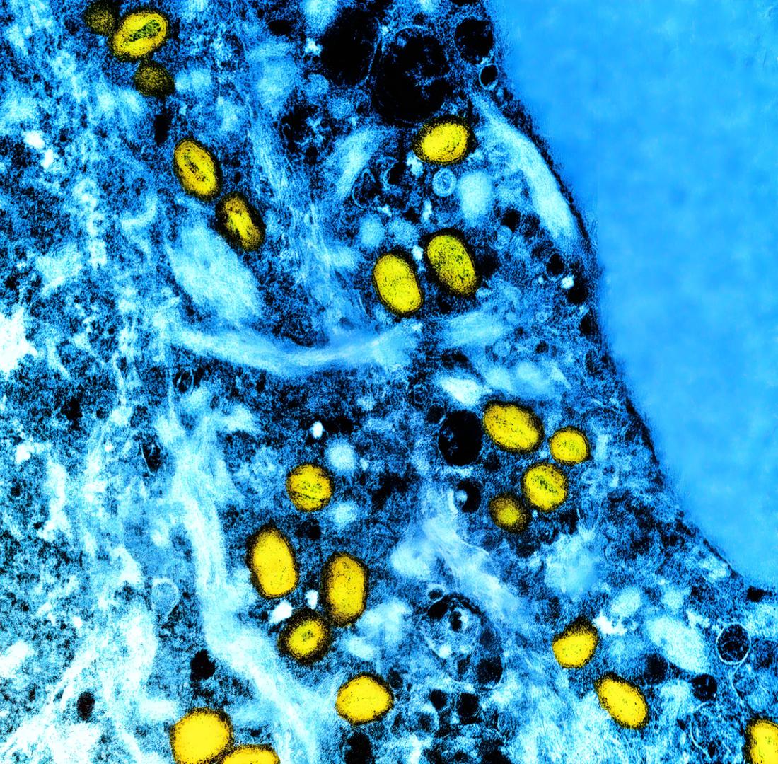 Mpox-Viruspartikel (gelb) unter dem Transmissionenelektronenmikroskop